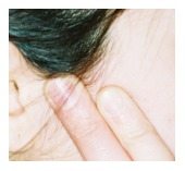 Temporo-mandibular Joint