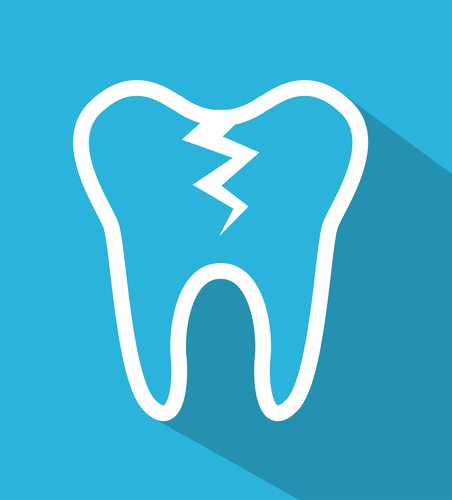 blue graphic vector of tooth with crack down the middle