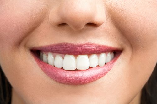 A closeup of a woman's mouth smiling and showing healthy teeth.